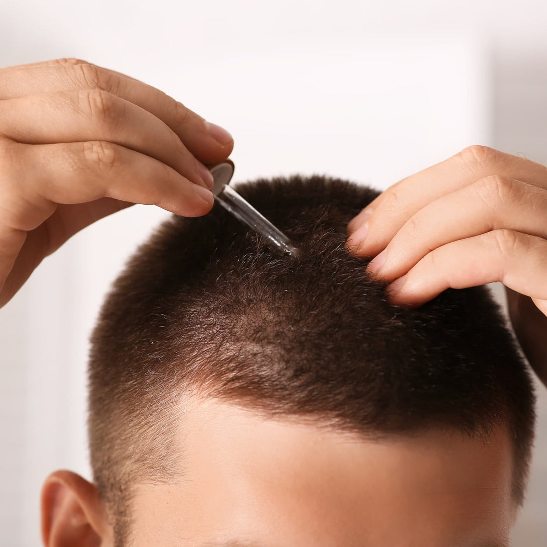 man applying rosemary oil to her